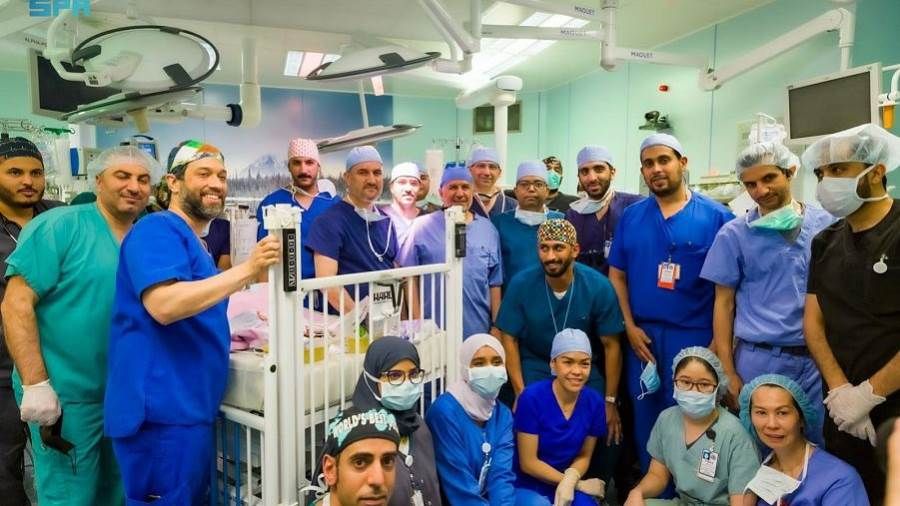 نجاح فصل التوأم السيامي اليمني "يوسف وياسين" الملتصقين بالرأس في عملية استغرقت 15 ساعة