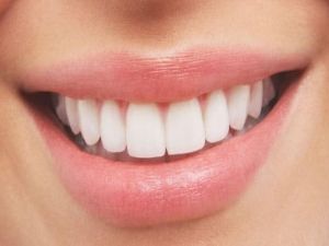 وداعًا لطبيب الأسنان .. من داخل منزلك يمكنك تبيض اسنانك من الاصفرار وإزالة الجير نهائيا