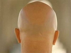 موجود بكل بيت .. عصير شائع له مفعول سحري في وقف التساقط و تعزيز نمو الشعر بغضون أسبوعين!