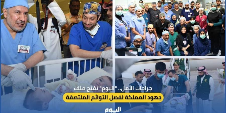 جراحات الأمل.. "اليوم" تفتح ملف جهود المملكة لفصل التوائم الملتصقة - الخليج الان