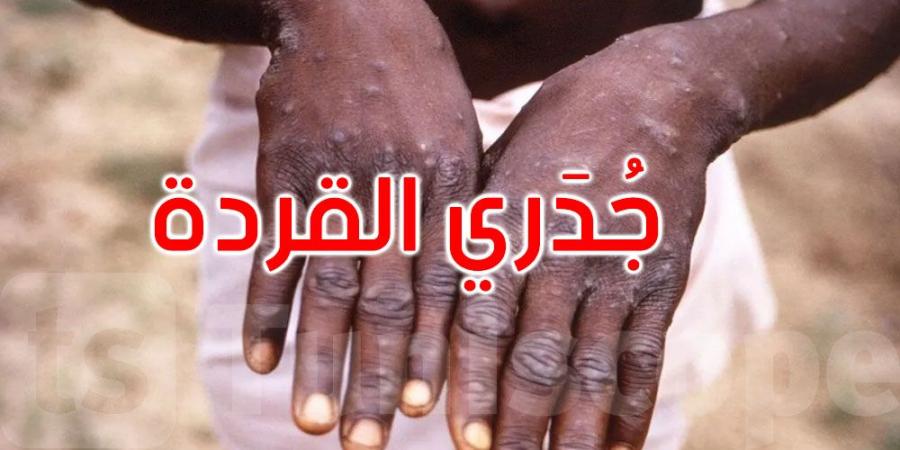 رصد أول إصابة بسلالة جدري القردة الجديدة في نيويورك - الخليج الان