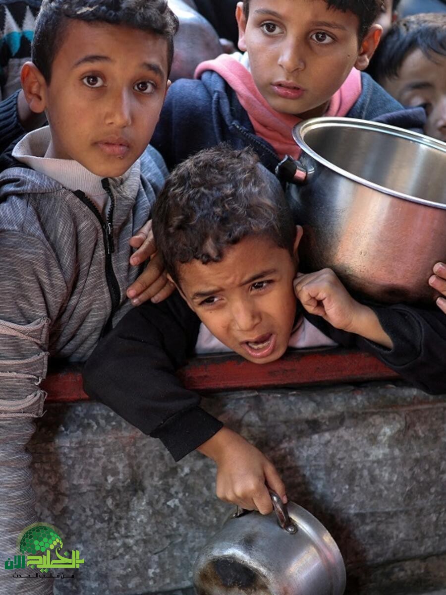 أزمة غزة الإنسانية .. الجوع يهدد الأطفال(1)